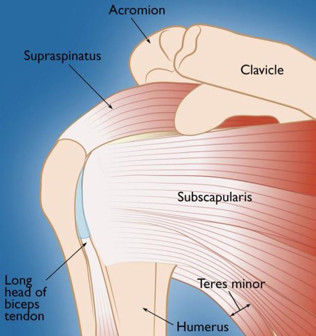 rotator cuff tear