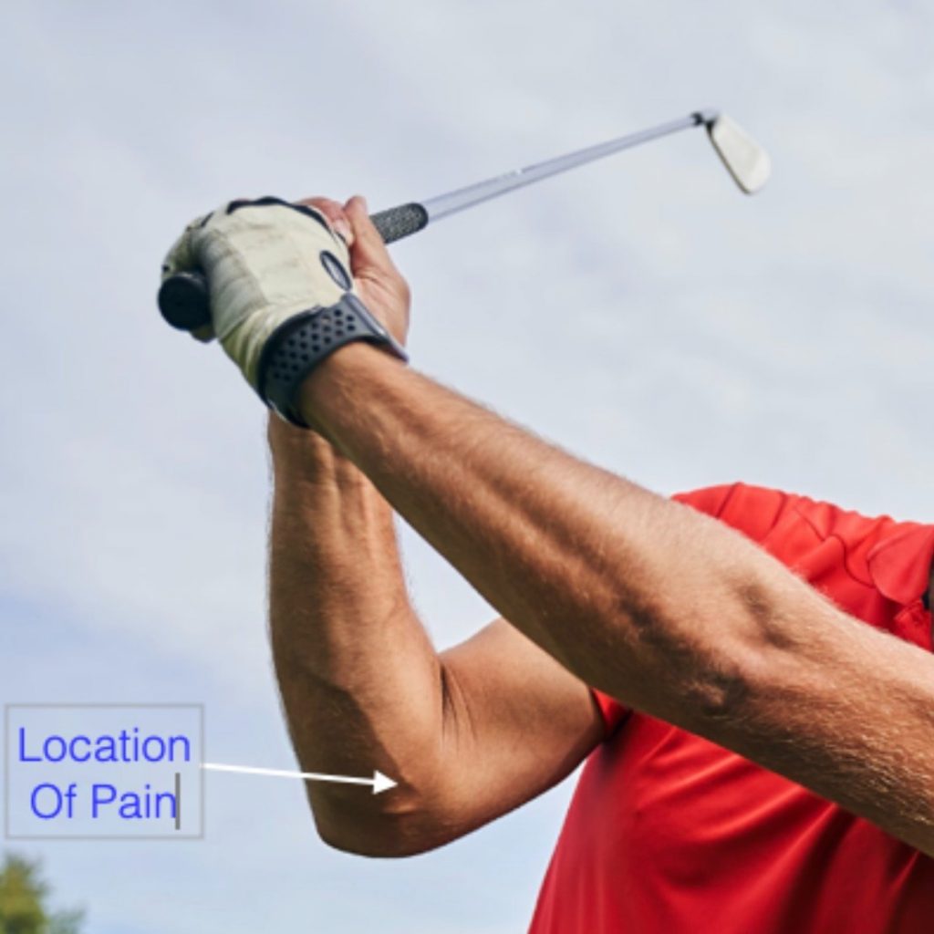 golfers elbow pain