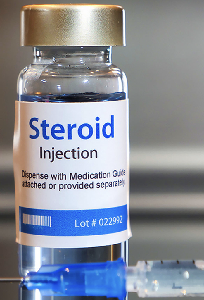 steroid injection