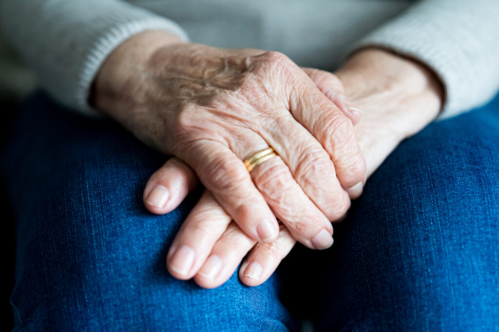 hands of arthritis patient