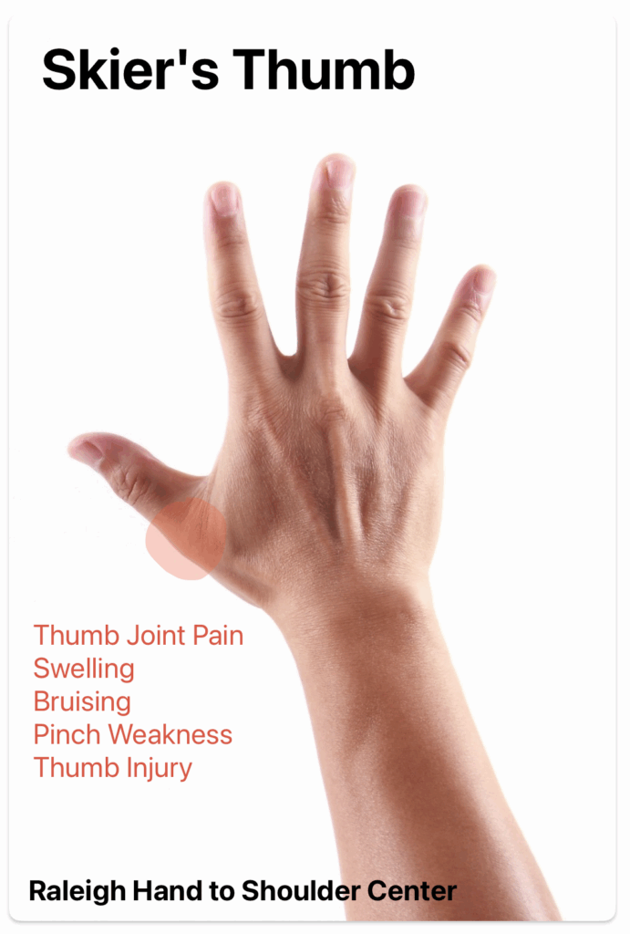 skiers thumb